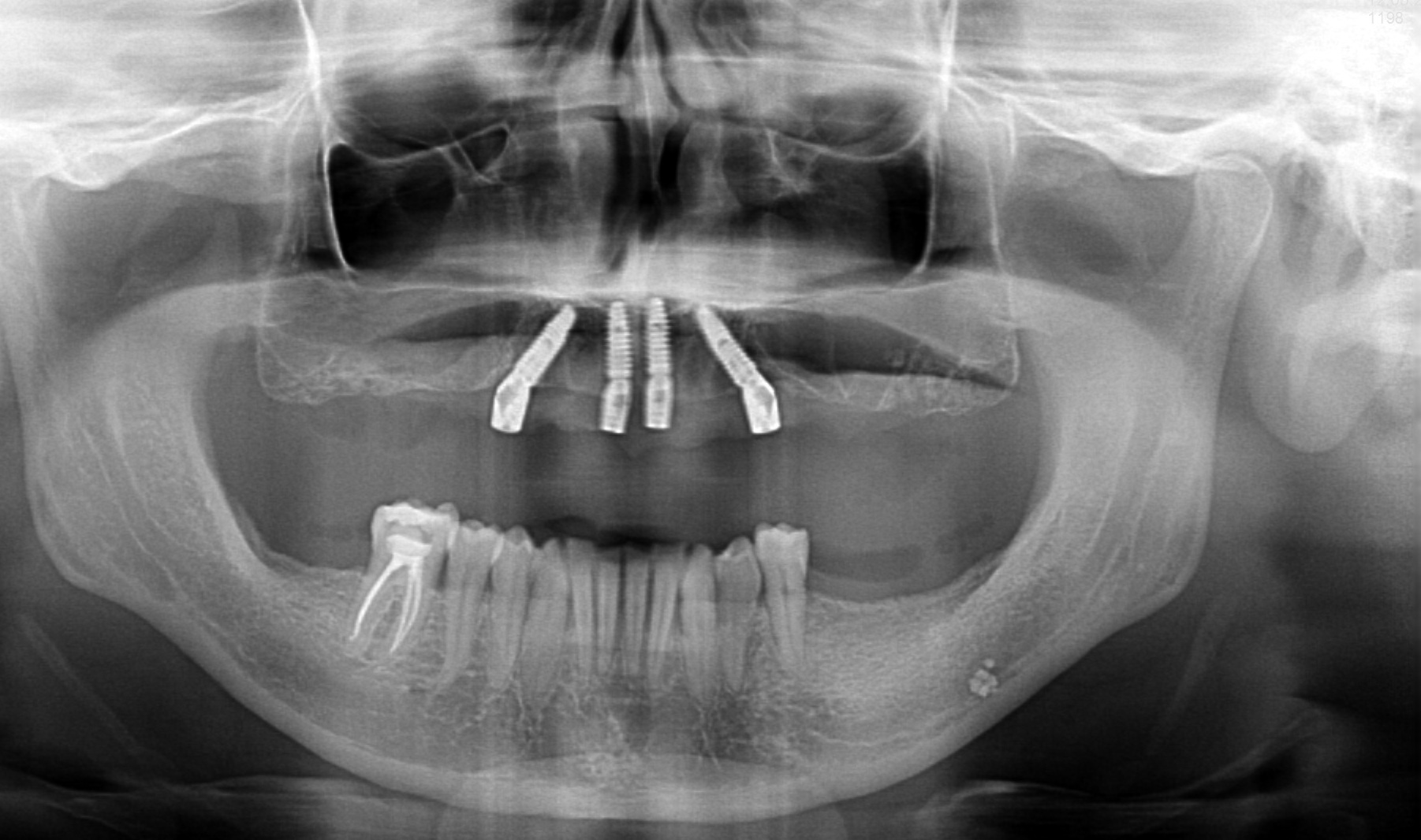 All on X - Niepołomice, Małopolska