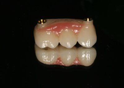 Most oparty na implantach Niepołomice