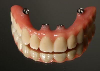 Protetyka na implantach Niepołomice