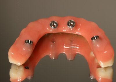 Komfrotowe protezy Niepołomice