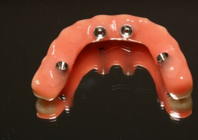 Implantoprotetyka Niepołomice